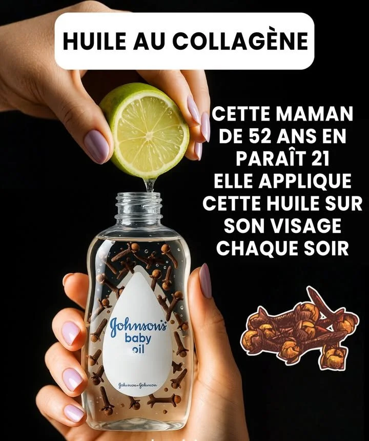 Flacon d'huile de clou de girofle et citron pour peau éclatante